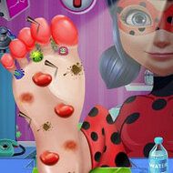 Ladybug Foot Surgery